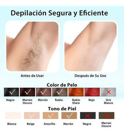 DEPILADORA LASER IPL