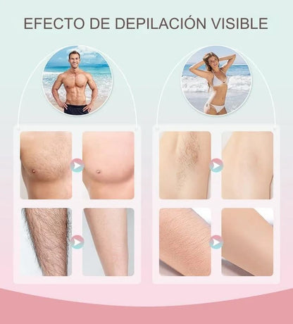 DEPILADORA LASER IPL