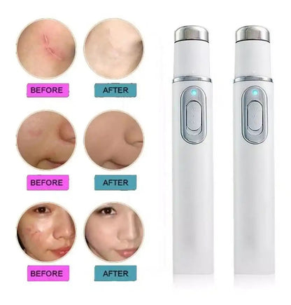 SkinLuz 💙