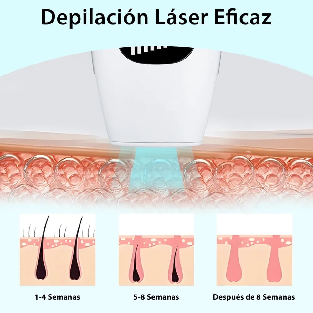 DEPILADORA LASER IPL