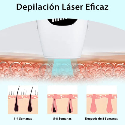 DEPILADORA LASER IPL